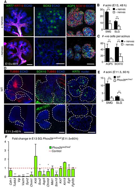 Figures And Data In Sox Regulates Acinar Cell Development In The