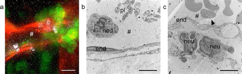 Vessel Segment Undergoing Neutrophil Extravasation During Cutaneous