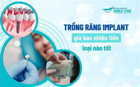 Trồng răng implant giá bao nhiêu tiền loại nào tốt