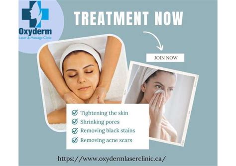 Laser Clinic For Skin Tightening In Edmonton Ppt