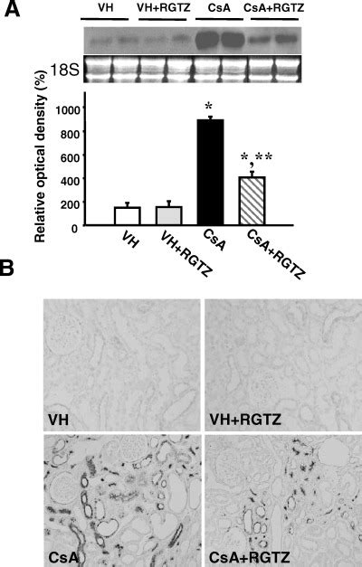 Effect Of Rgtz On Osteopontin Mrna And Protein Expression In Chronic