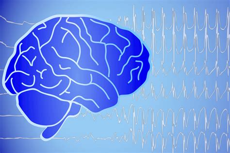 Diagnose Einer Epilepsie Anamnese Eeg Mrt