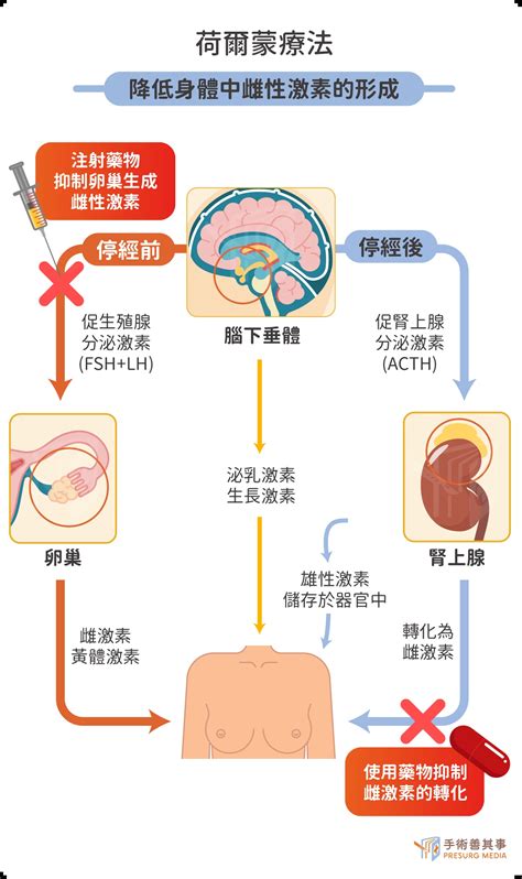 乳癌存活率有多少？症狀、前兆、檢查、治療方式