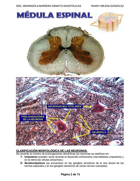 SOLUTION 1 Snc M Dula Espinal Cerebro Cerebelo Meninges Barrera Hemato