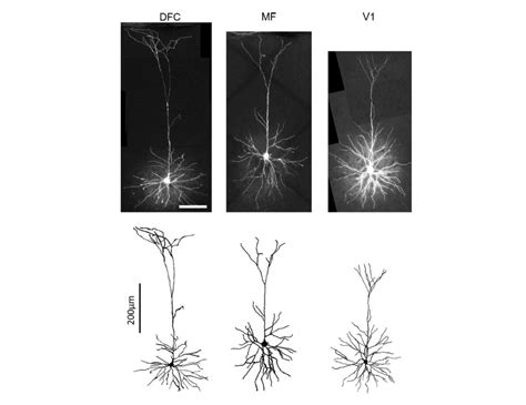 Regional Specialization Of Pyramidal Neuron Morphology And Physiology