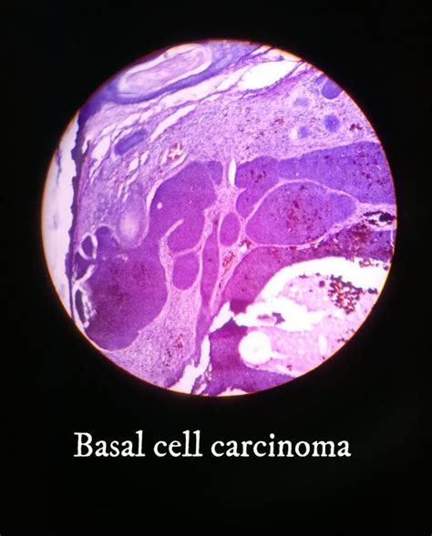 Pathology Medizzy