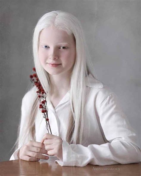 Photographer Captured The Unique Beauty Of A Girl With Albinism And Heterochromia