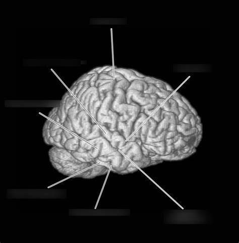 Temporal Lobe Sulci And Gyri Diagram Quizlet