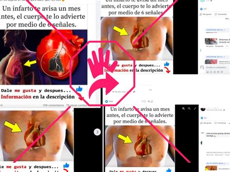 Cómo te avisa el cuerpo antes de tener un infarto Actualizado