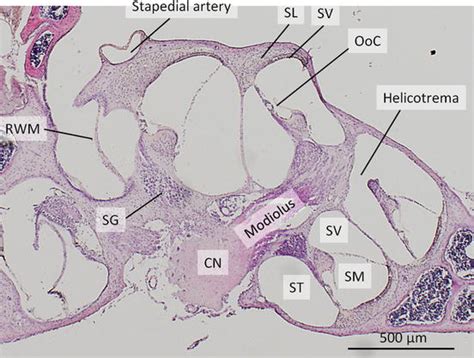 Cochlea Histology Labeled