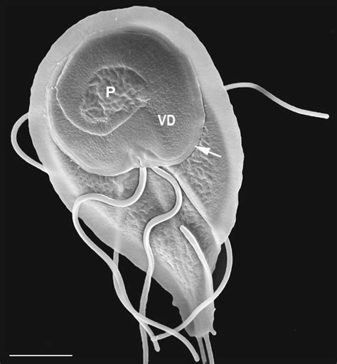 A General View Of A G Intestinalis Trophozoite As Seen By Conventional Download Scientific