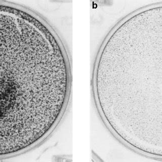 Keratinocyte Proliferation Is Inhibited By Rapamycin Normal Epidermal