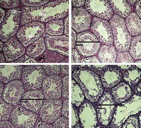 Microscopic Images Of Testis Slides Of Adult Group Days After