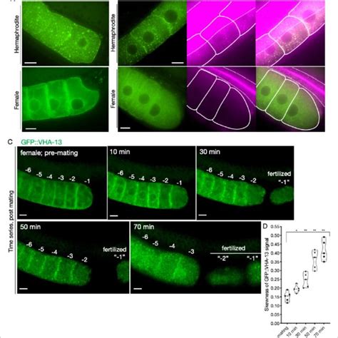 Sperm Dependent Lysosomal Localization Of Vha A Distribution Of