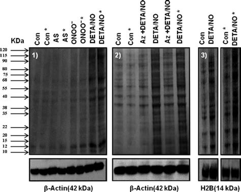 Biotin Switch Assay To Determine The Extent Of Protein S Nitrosylation Download Scientific