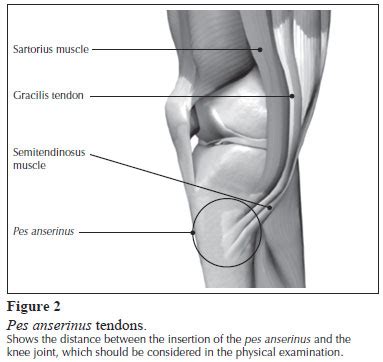 Pes Anserine Bursitis Anatomy