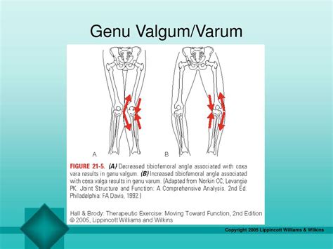 Ppt Chapter 21 The Knee Powerpoint Presentation Free Download Id