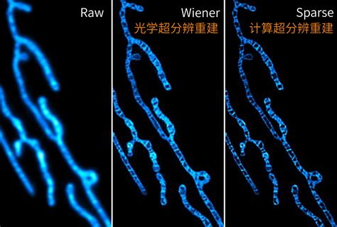 His Sim 智能超灵敏活细胞超分辨显微镜 广州超视计生物科技有限公司