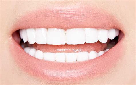 How Much Do Porcelain Veneers Cost A Comprehensive Guide To Price And