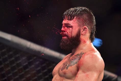 Mike Perry got his nose completely shattered in his latest UFC fight | CNN