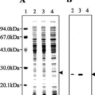 Electrophoretic Analysis And Immunoblotting Of The Strains Tested The