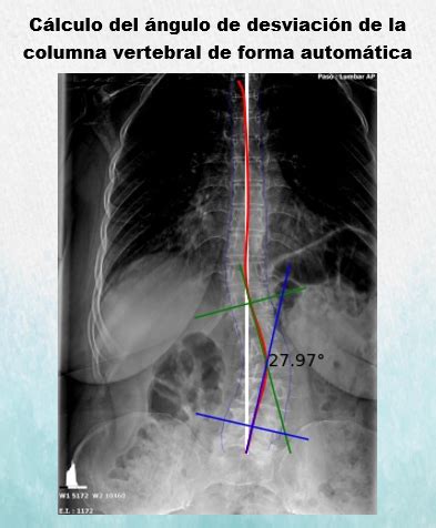 Repositorio Digital Universidad T Cnica Del Norte An Lisis De Im Genes