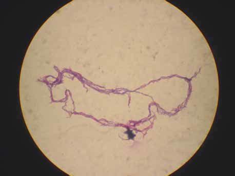 Mycobacterium Tuberculosis Laboatlas Off