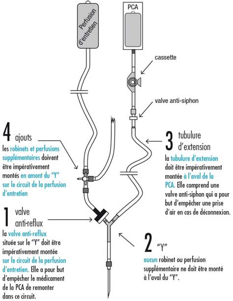 Pose D Une Pompe Pca Morphine Prise En Charge De La Douleur Aigu