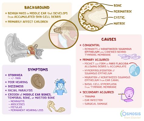 Cholesteatoma: What It Is, Causes, Signs, Symptoms | Osmosis