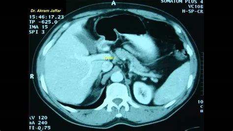 X Ray Abdomen Anatomy - Anatomical Charts & Posters