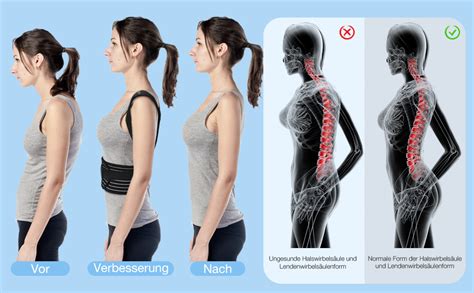 ZINUU Rücken Geradehalter Haltungskorrektur Rückenstützgürtel