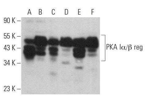 PKA Iα β reg抗体 B 6 SCBT Santa Cruz Biotechnology