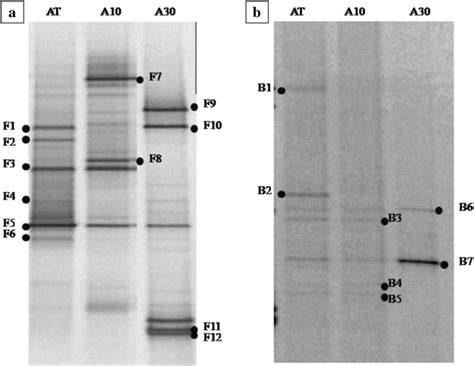 Denaturing Gradient Gel Electrophoresis Profiles Of Pcr Amplified