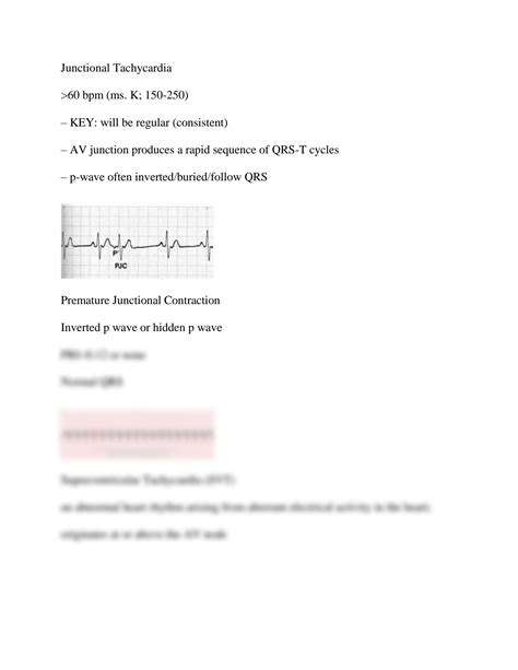 SOLUTION Relias Dysrhythmia Basic Test Answers Studypool