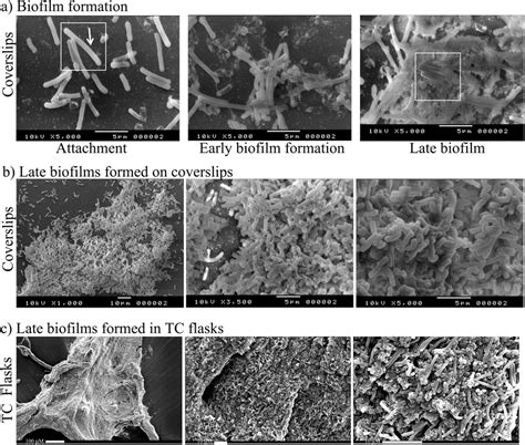 A Schematic And Sem Visualisation Of Biofilm Formation Of C Difficile