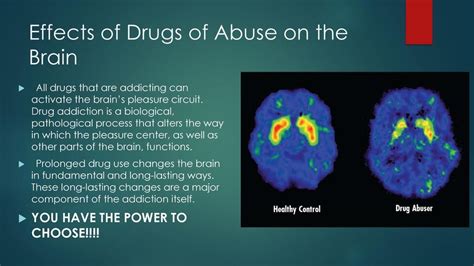 Effects+of+Drugs+of+Abuse+on+the+Brain - Montgomery Municipal Cable ...