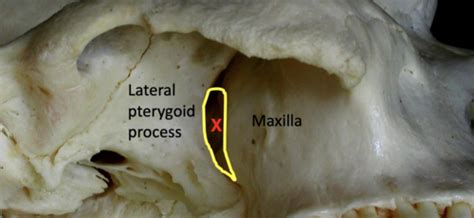 Pterygopalatine Fossa Flashcards Quizlet