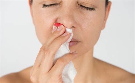 9 Effective Home Remedies To Stop Nose Bleeding Blogdietnews