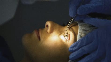 Lasik Eye Surgery Is It Worth The Risk