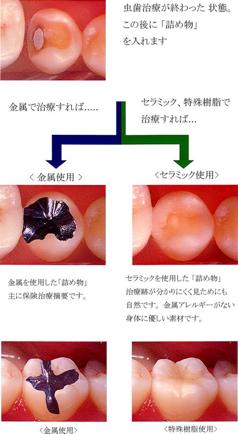 eohb