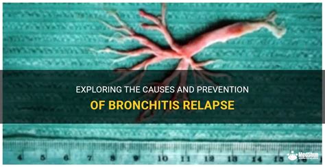 Exploring The Causes And Prevention Of Bronchitis Relapse Medshun