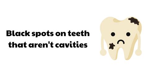 Black Spots On Teeth That Aren't Cavities? - Spring Orchid Dental