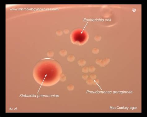 Pseudomonas Aeruginosa Lactose Negative Colonies On Macconkey Agar