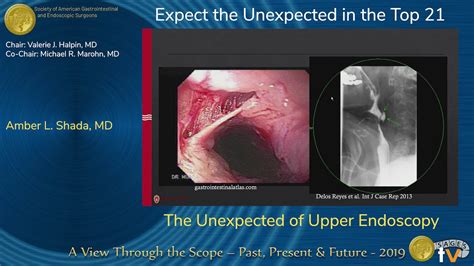 Abnormal Endoscopy Findings At John Phillips Blog