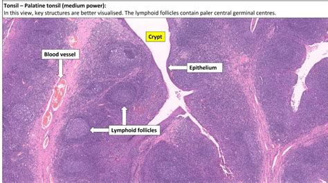 Tonsil – Normal Histology – NUS Pathweb :: NUS Pathweb