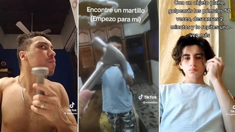 Bone Smashing El Peligroso Reto Viral De Tiktok Que Pone En Riesgo