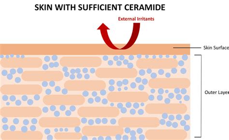 Eczema Management with Best Ceramide Moisturisers