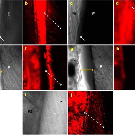 Micrographs Obtained By Confocal Laser Scanning Microscopy In