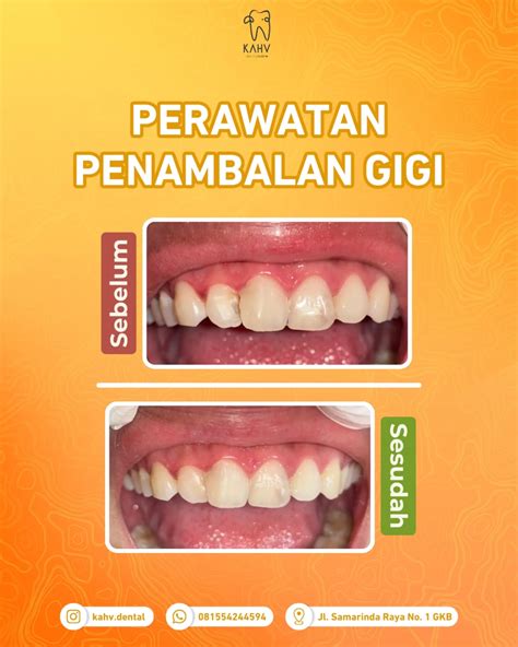 maksud mimpi gigi patah menurut islam 3