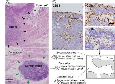 Macrophage Histology Em